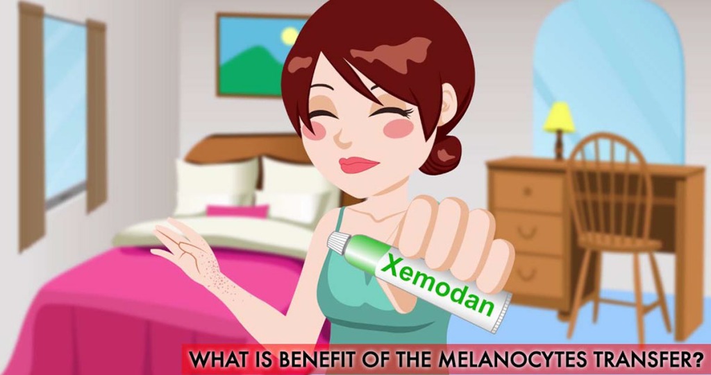 What is the benefit of the Melanocytes transfer?